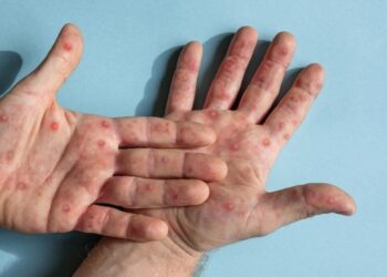 Foto ilustrasi: iStock