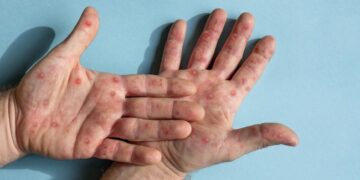 Foto ilustrasi: iStock