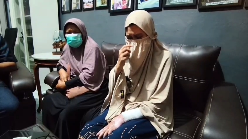 Seorang wanita muda menjadi korban penyiksaan oleh oknum anggota polisi hingga mengalami luka bakar di hampir separuh tubuhnya (Foto : Darfan)